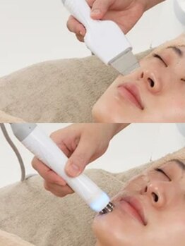フルールの写真/美肌の決め手は皮脂&毛穴対策【洗浄&引締め+保湿★毛穴洗浄コ-ス】【ニキビケア/シミ改善★乳酸ピ-リング】