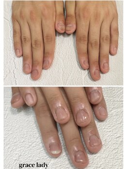 グレースレディ 神戸北店/