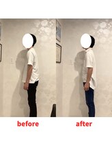 ナオル整体 福岡香椎院(NAORU整体)/20代男性施術事例【姿勢改善】