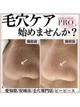 ビーピース(B peace)/毛穴エクストラクションプロ