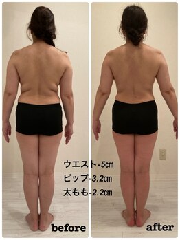 シルク(SILK)/痩身３回のBefore&After