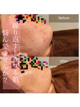 クウラ 学園前店(KUULa)/ビフォーアフターで体感！