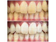 ホワイトニングルーム 横浜店(Whitening Room)/ホワイトニング/横浜