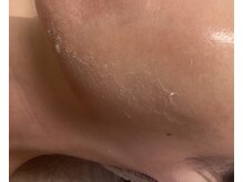 メンズブリリアンス/くすみもしっかり浮上!!