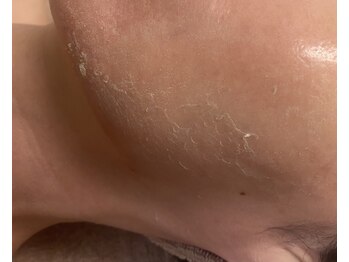 メンズブリリアンス/くすみもしっかり浮上!!