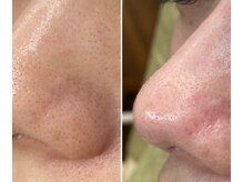 サイ(Sai)/before⇒after