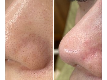 サイ(Sai)/before⇒after