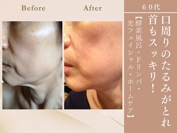 ケムズ インプルーブメントサロン(KMS IMPROVEMENT salon)/