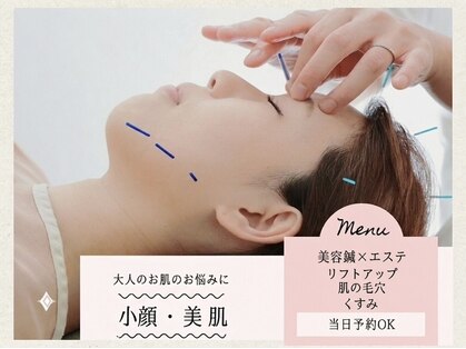 エスピーエー 桂坂(S.P.A)の写真