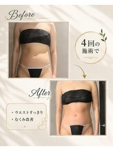 リンガ(Ringa)/腸活ケアで実感すっきり変化