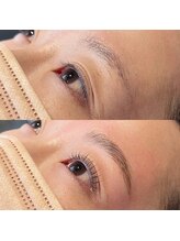 ラウネ(Laune)/ハリウッドブロウリフト(HBL)