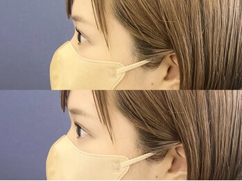 アイル(I'll)/横顔も綺麗に