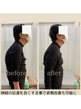 ハリボケア 葛西(haribo care)/姿勢改善プログラム