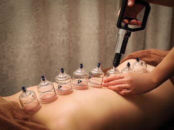 トゥビューティ 元町駅前店(To-Beauty)/カッピングー吸い玉