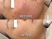 ミジョカフェイシャル(mijoka facial)