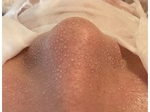 アンドモア 目黒(&more)の雰囲気（毛穴の奥の汚れまで、根こそぎスッキリ！）