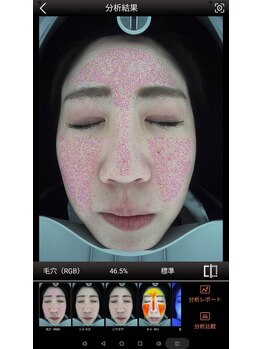 ミーシェ(Meshie)/AI肌診断機
