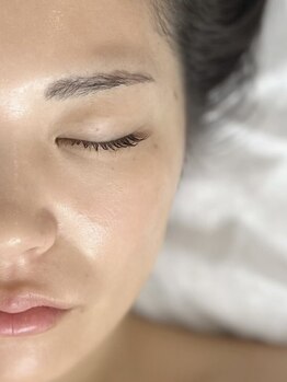 イム(im)の写真/【お化粧ノリも◎】ワックス脱毛で産毛や毛穴の汚れ、古い角質を取り除き化粧品の浸透を良くする！