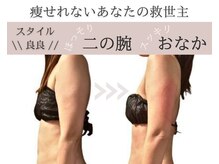 サロンドモフィ(salon de moffy)の雰囲気（脂肪冷却はダイエット失敗者の「救世主」です!! 四日市/痩身）