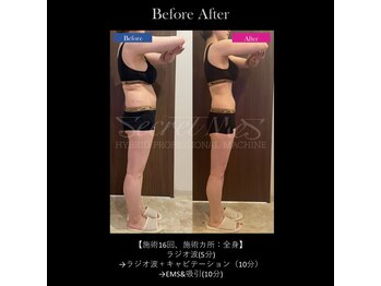 ミモサ 川中島温泉テルメDOME内(mimosa)/