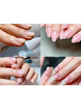 爪の悩みを解消できる（ケア含む）