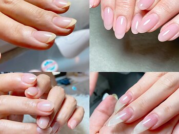 スマイル ネイル ラボラトリー(Smile nail laboratory)の写真/“結果重視の本格ケア”で地爪の健康を保ちながら指先を美しく♪ボロボロになったお爪も健康的な美爪に…☆