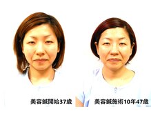 一丁目治療院/美容鍼