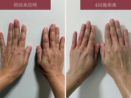 イユー(IU)の写真