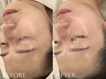 サロンブランシュ(salon BLANCHE)/艶肌WAX＋CHRISTINA