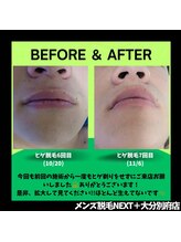 ネクストプラス 大分別府店(NEXT+)/ビフォーアフター