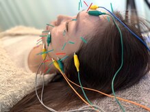 北てんま整骨鍼灸院の雰囲気（カウンセリングにて、お肌のお悩みに合わせて施術します。）