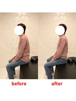 ナオル整体 福岡香椎院(NAORU整体)/60代男性施術事例【猫背】