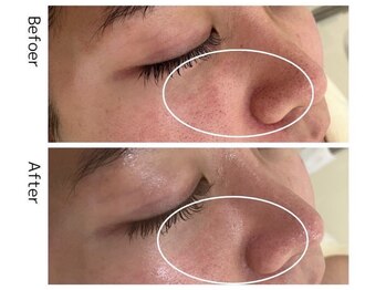 ファッショニスタ 渋谷(Fashionista)/