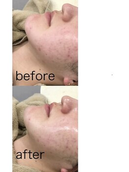 ティアム バイ テトテ 神戸三宮(TIAM by tetote)/ララピール