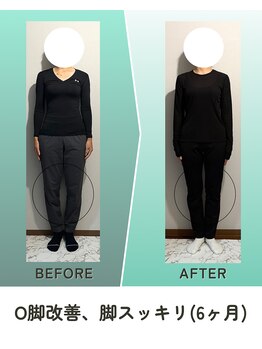 縁/ビフォーアフター