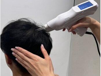 リジェネラティブセル メディカルサロン(Regenerative Cell Medical Salon)の写真/年齢・ストレスと共に弱ってきた頭皮にオススメ！頭皮環境を整えて、弱った毛根・硬くなった頭皮をケア◎