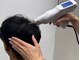 リジェネラティブセル メディカルサロン(Regenerative Cell Medical Salon)の写真/年齢・ストレスと共に弱ってきた頭皮にオススメ！頭皮環境を整えて、弱った毛根・硬くなった頭皮をケア◎