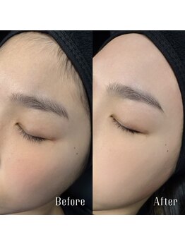 カイリー(KYREE)/HBL+FACE WAX