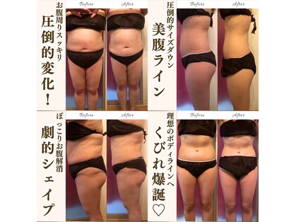リンパケアサロン ジュビル(Jubil)の写真