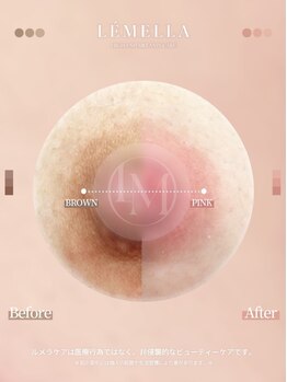 フリュール(FLEUR)/ルメラメラニンケア☆黒ずみ解消