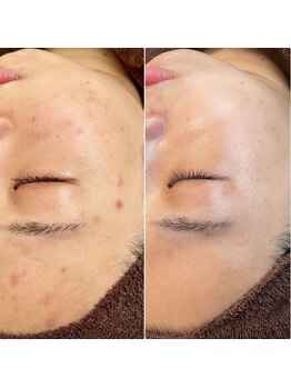 サロンドジョリーの写真/素肌から咲く美しさ。大人の肌悩みに寄り添う、上質な肌ケア