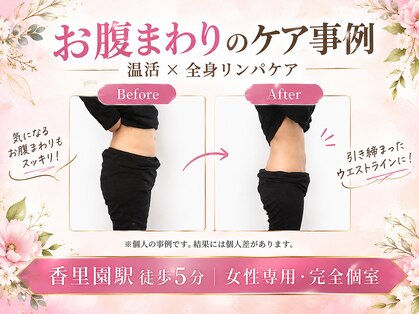 ヨサパーク ソルナ(YOSA PARK Soluna)の写真