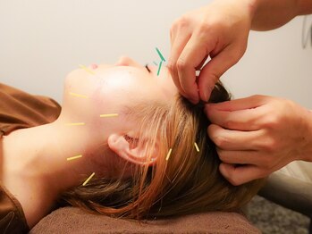 トップグレード鍼灸院(TOP GRADE鍼灸院)/美容施術