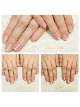 グレースレディ 神戸北店/