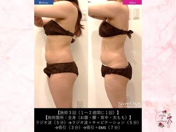 サロンドモアロ(Salon de Moaro)/Before/After