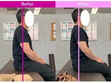 八女整体院/～姿勢改善～肩こり