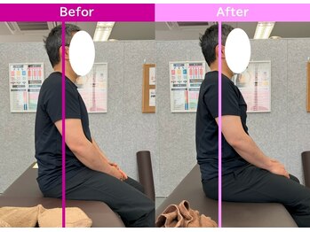 八女整体院/~姿勢改善~肩こり