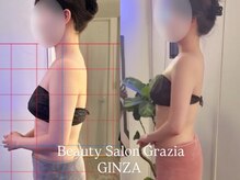 グラツィア 銀座(Grazia)/8回【 ブライダルエステ整体 】