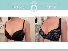 美人バスト 浜松店/◇ バストアップ &nbsp;BeforeAfter◇