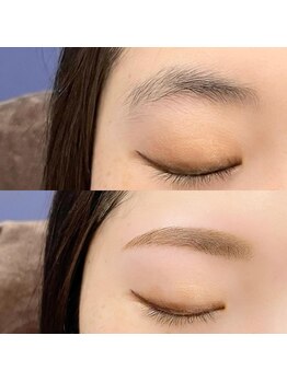 アイル(I'll)/自然で美しく